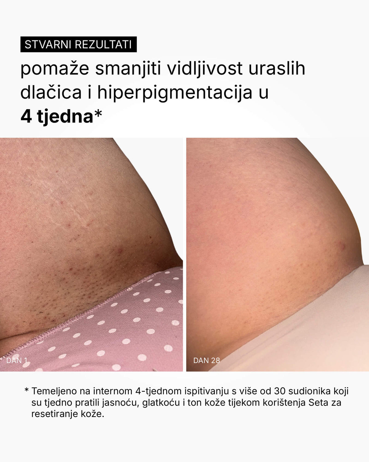 Skin Reset Set - Routine per tutto il corpo