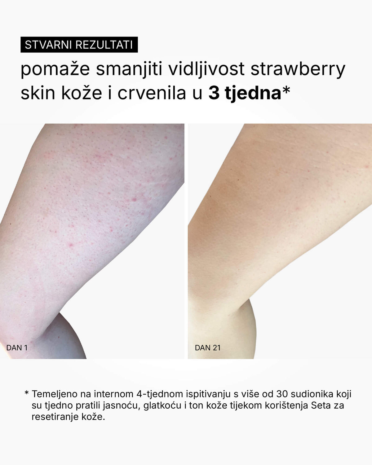 Skin Reset Set - Routine per tutto il corpo