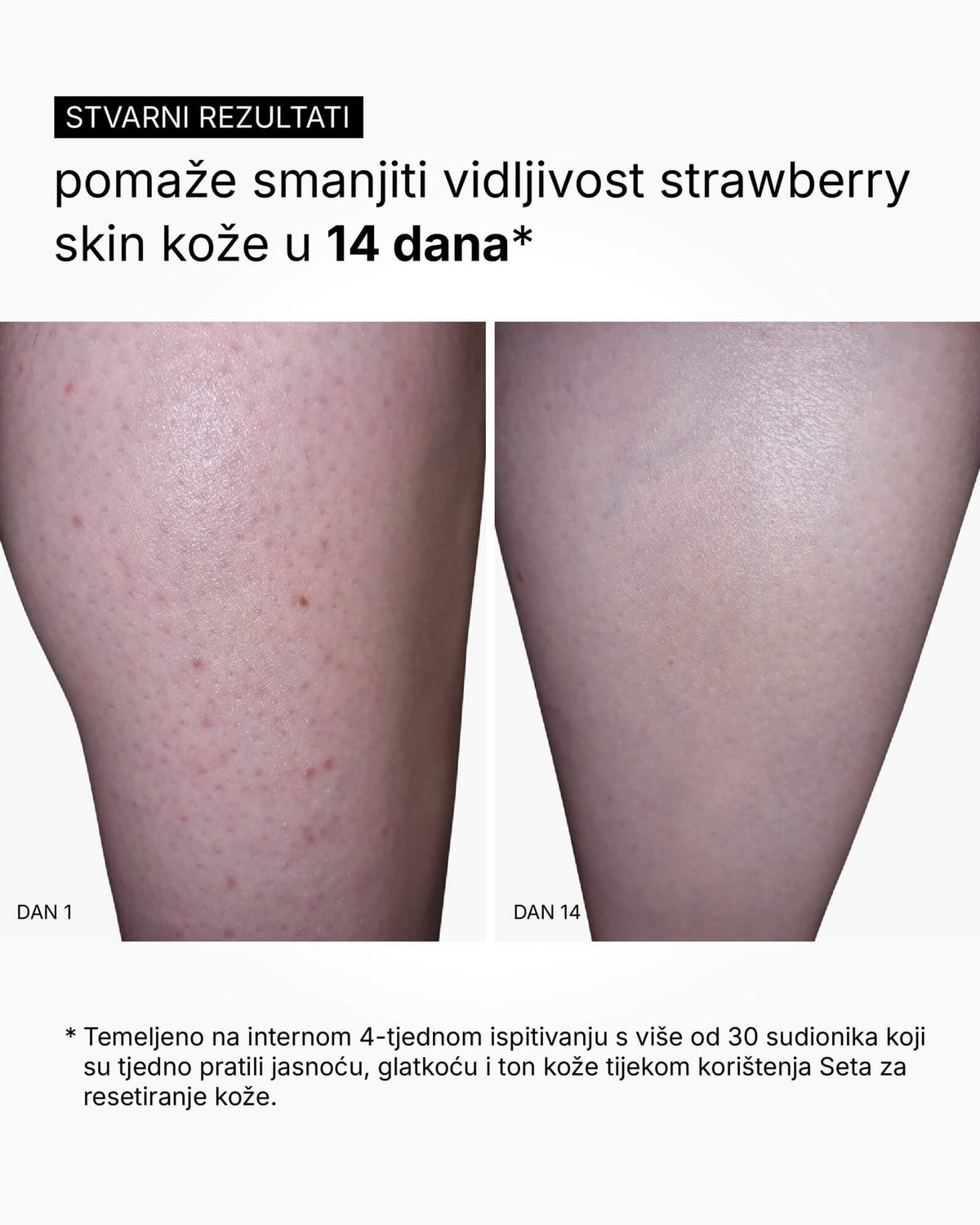 Skin Reset Set - Routine per tutto il corpo