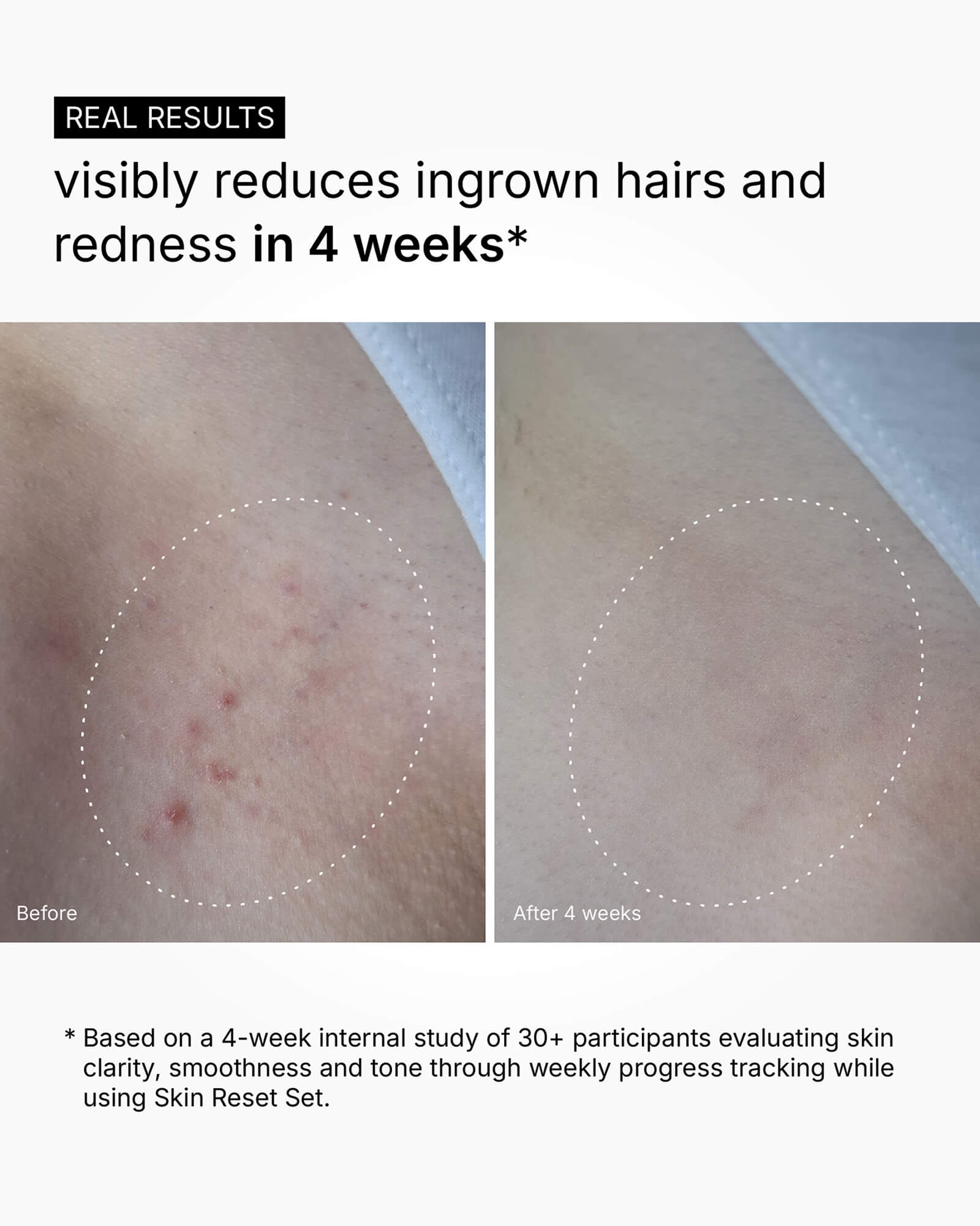 Skin Reset Set - Full Body Routine