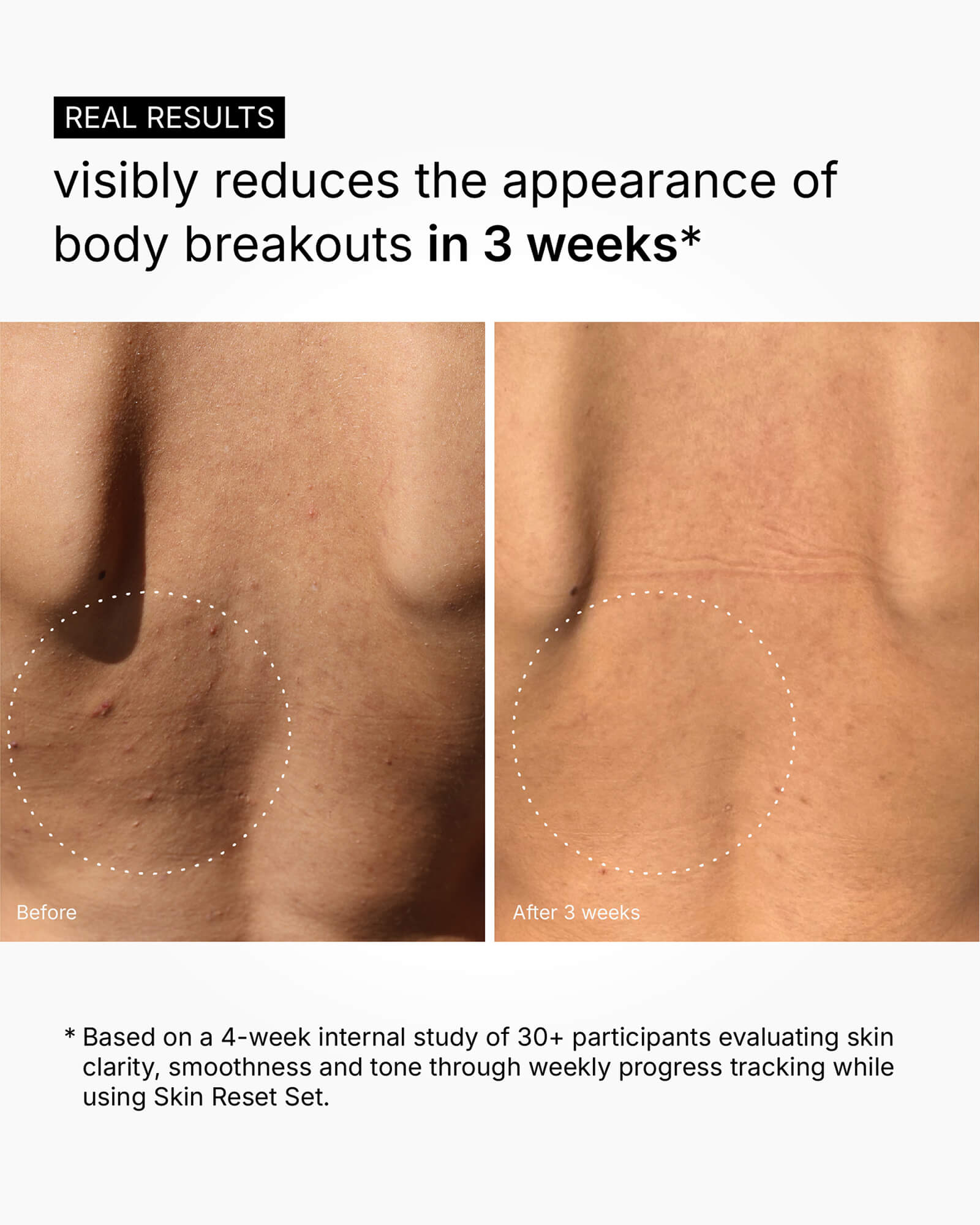 Skin Reset Set - Full Body Routine